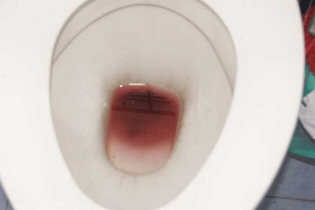 उत्तेजित होने पर पुरुषों में स्पॉटिंग